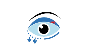 Chalazion icon